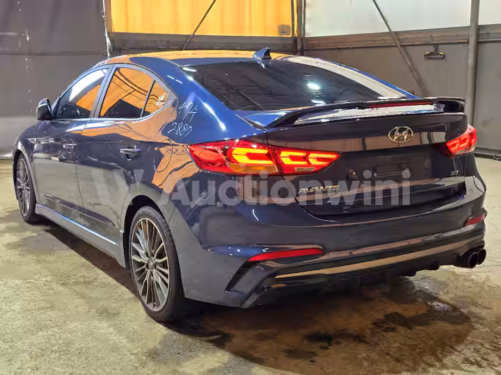 Hyundai Avante 2018 — 4