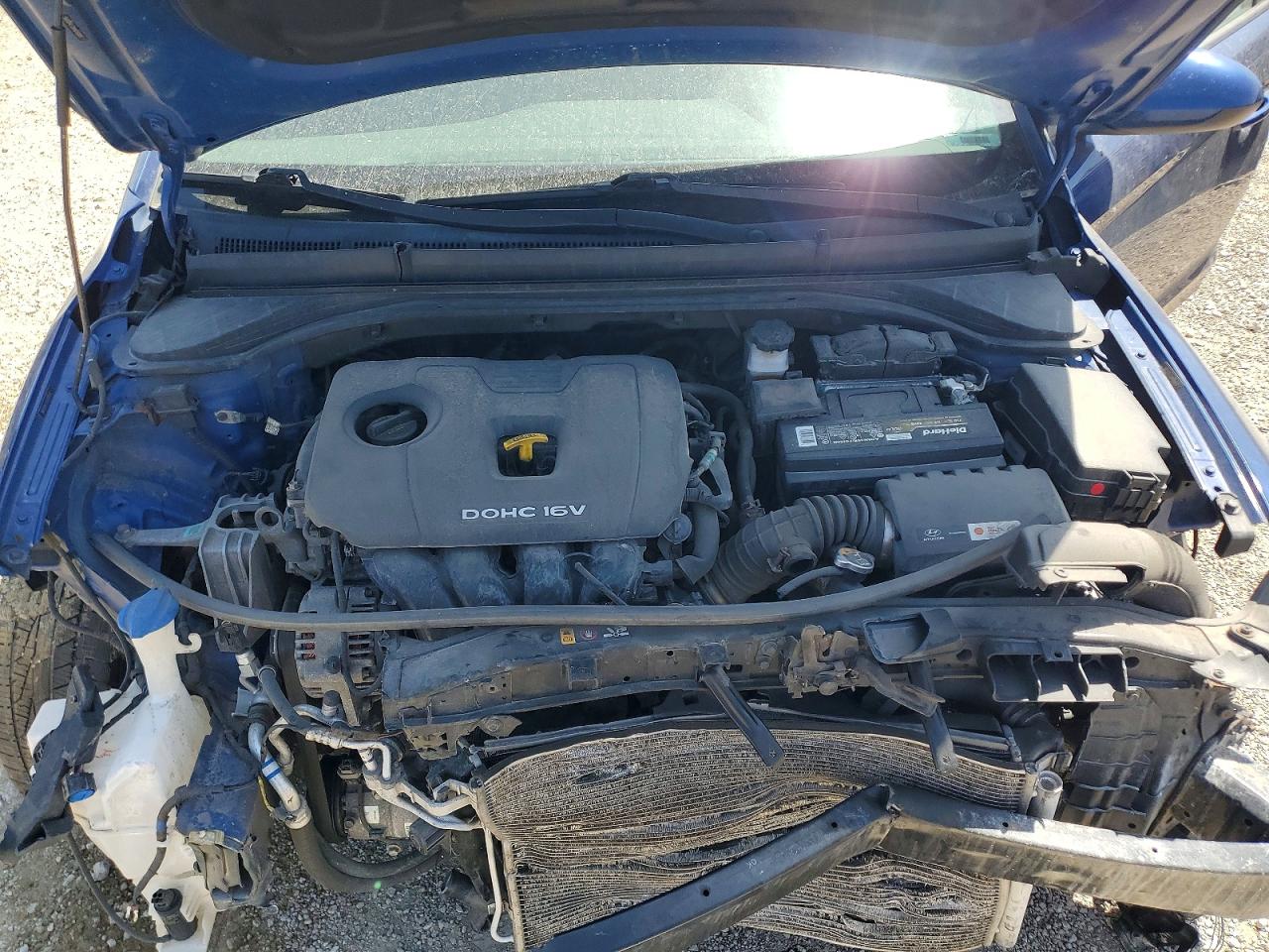 HYUNDAI ELANTRA 2017 — 12